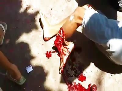 SERIOUS ACCIDENT IN BRAZIL