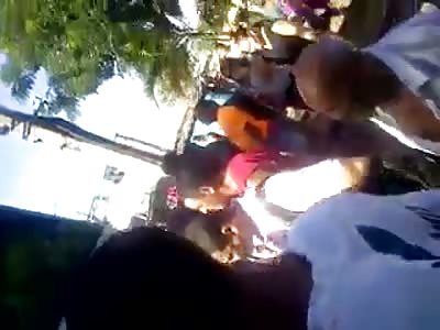 *BRAZIL* Kid in pure agony has BOTH legs nearly ripped off because of a train accident