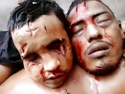 scenes of massacre in ( Pedrinhas M.A Brazil)