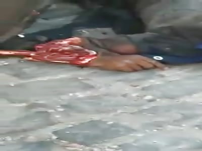 Old man killed by truck