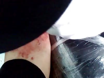 my scarification 666