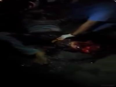 MAN IN TOTAL AGONY HAVE A LEG CRUSHED IN AN ACCIDENT