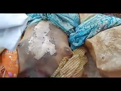 POOR WOMAN WAS KILLED BY LIGHTNING