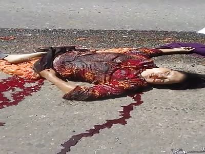 EXTREMELY GRAPHIC: COUPLE HAVE SHATTERED BODIES IN AN ACCIDENT 