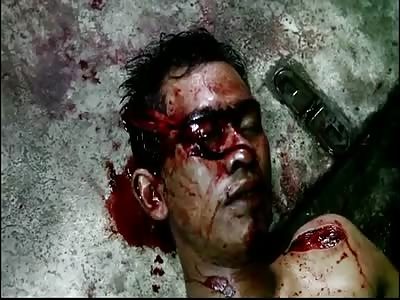 MAN IN SHOCK AFTER BEING STABBED