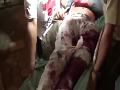 RIDER HAD HIS HAND DESTROYED IN ACCIDENT