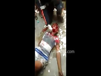 MAN IN AGONY AFTER BEING SHOT IN THE HEAD