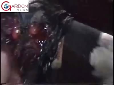 HE DIED WITH HIS GENITALIA SHATTERED IN AN ACCIDENT