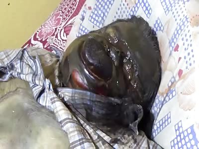 ELDERLY MAN'S CORPSE FOUND IN DECOMPOSITION 