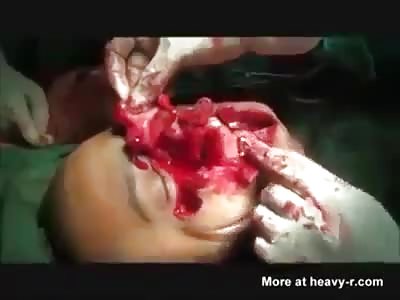 NAH... BREATHE EASY! JUST 2 OR 3 STITCHES AND HE WILL BE FINE AGAIN!