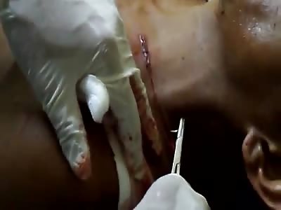 32 YEARS-OLD MAN NEARLY DIES WITH 'MACHETAZOS'