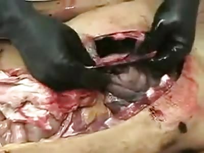 AUTOPSY OF A MAN SHOT DEAD