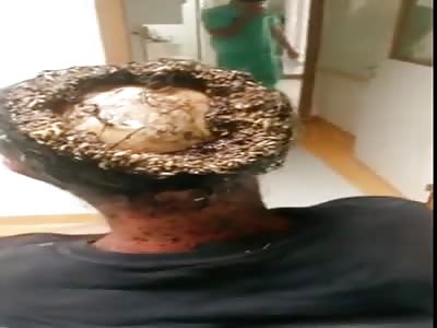 HEAD CROWNED WITH MAGGOTS