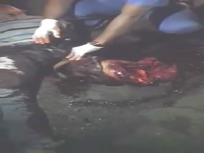 MAN SMASHED HIS LEFT KNEE IN AN ACCIDENT