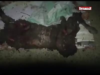 MAN'S BODY WAS SHATTERED IN BOMBING