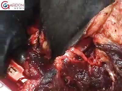 SHOCKING: MAN DIED RUN OVER BY VEHICLE