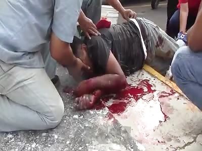 WORKER IS RESCUED AFTER SCAFFOLDING COLLAPSE