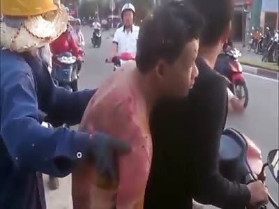 BURNED MAN IS TAKEN BY MOTORCYCLE TO THE HOSPITAL