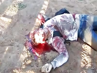 THEY TRIED TO ASSAULT A POLICE: ONE ARRESTED AND ANOTHER SHOT IN THE HEAD