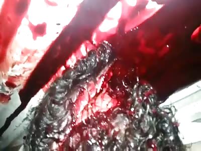 MAN SUFFERED SKULL FRACTURE AND DIED