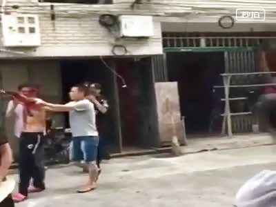 MAN IN SHOCK WITH THE ARM TORN APART BY FIREWORKS