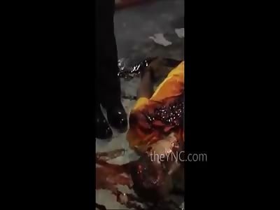 HEAD SHATTERED BY SHOTS 