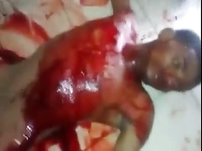 MAN DYING AFTER BEING INJURED BY POLICE SHOTS