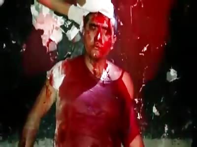 THIEF WAS CAUGHT AND SEVERELY INJURED BY MACHETE