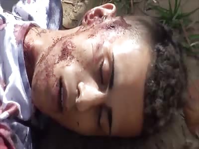 KILLED IN BROAD DAYLIGHT AND THE BLOOD STILL GUSHING FROM BULLET HOLE