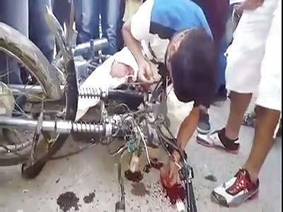 BIKER CRASHES WITH SEMI-TRUCK AND HAD A BRAIN CONCUSSION