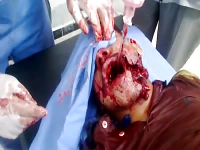 MAN HIT BY SHRAPNEL (OLD FILES)