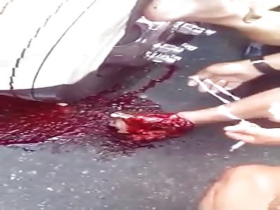 PAINFUL: MAN HAS CRUSHED FOOT IN AN ACCIDENT