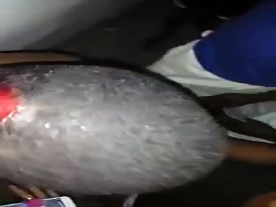 MAN SUFFERED AN ACCIDENT AND REFUSES TO GO TO HOSPITAL