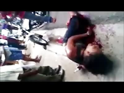 BOY WAS DISPLACED LEG IN MOTORCYCLE ACCIDENT (WITH ORIGINAL SOUND)