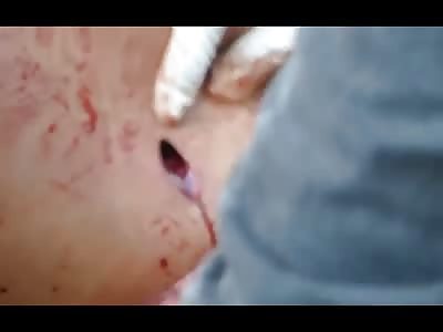 JEALOUS MAN STABBED MASON