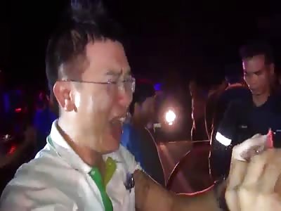 DRIVER BURNED TO BONE AFTER CAR ACCIDENT