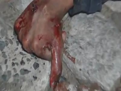 18 YEARS AGE MAN WAS KILLED WITH VARIOUS SHOTS