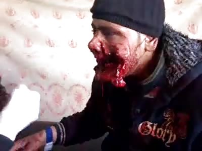 MAN WITH HUGE INJURY IN FACE
