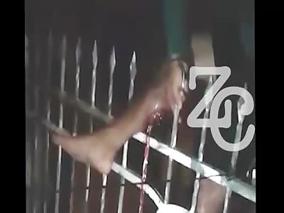 THIEF HAD THE LEG PIERCED BY FENCE