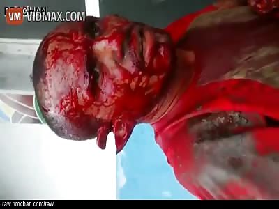 just another dull machete attack