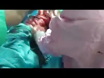 They should have cut his head.