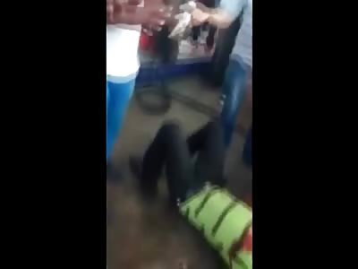 Man has his arm melted off by hot engine hood