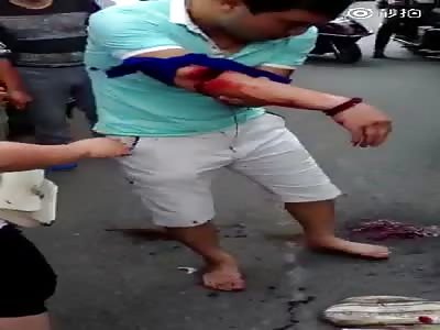 Man arm hacked broken by lunatic