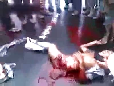  Accident aftermath .. Guy's leg torn off.. Horrible scene .. Man hit by truck 