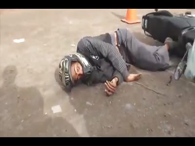 Man murdered still has bullet pancaked in his head