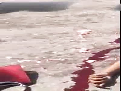 Aftermath of an accident.. Very shocking . Truck hits a bike 