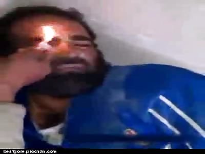 Man Tortured by Having His Face Burned with Lighter, and Forced to Drink Human Waste 