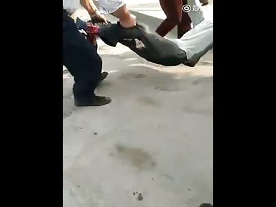 Man foot severed in traffic accident