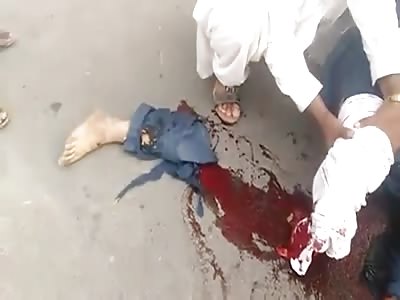 Guy lost his leg in bike accident somewhere in Pakistan... 