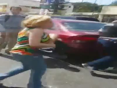 Mum carries her sons severed leg